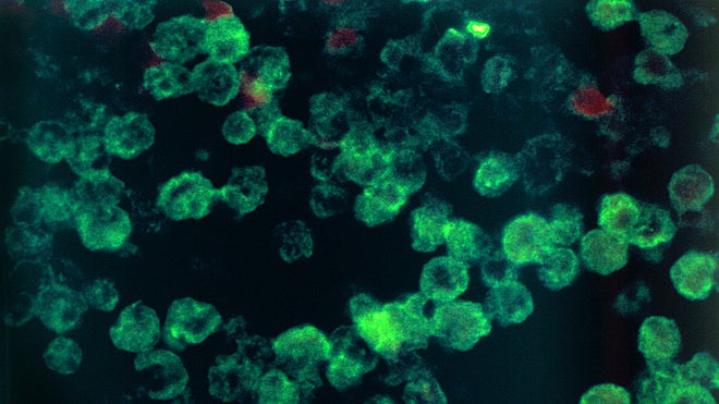 braineatingamoeba.jpg