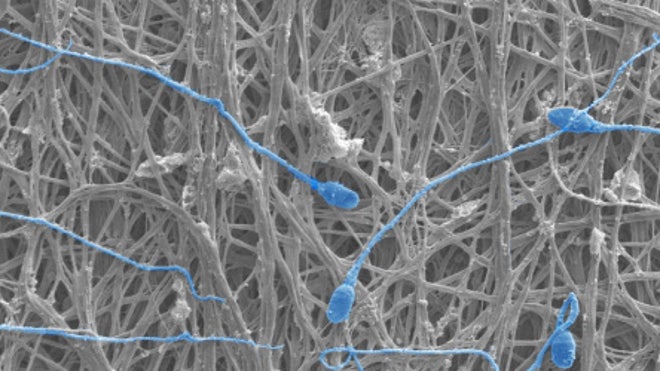 fibers-and-sperm.jpg