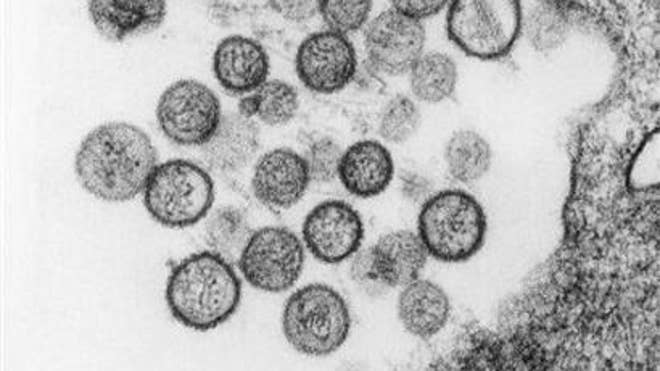 hantavirus