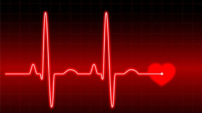 Heart Monitor
