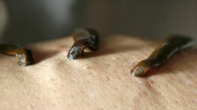 leeches.jpg