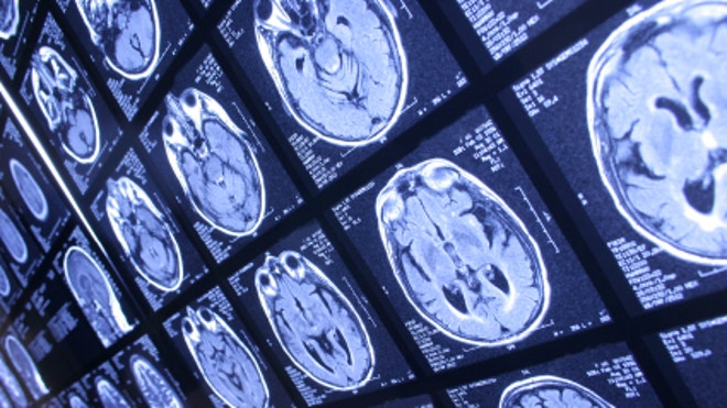 mri
