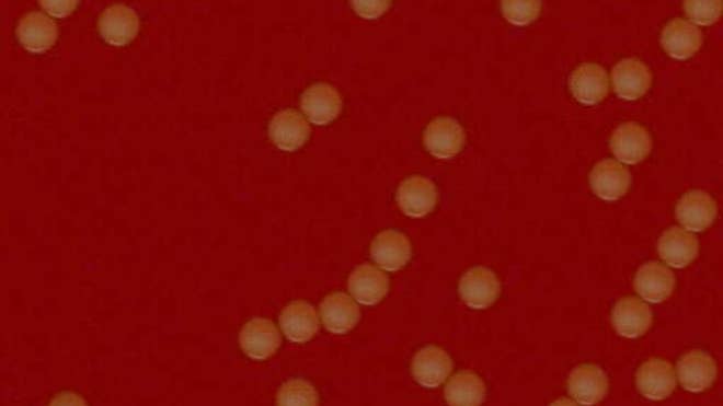 staph_bacteria.jpg
