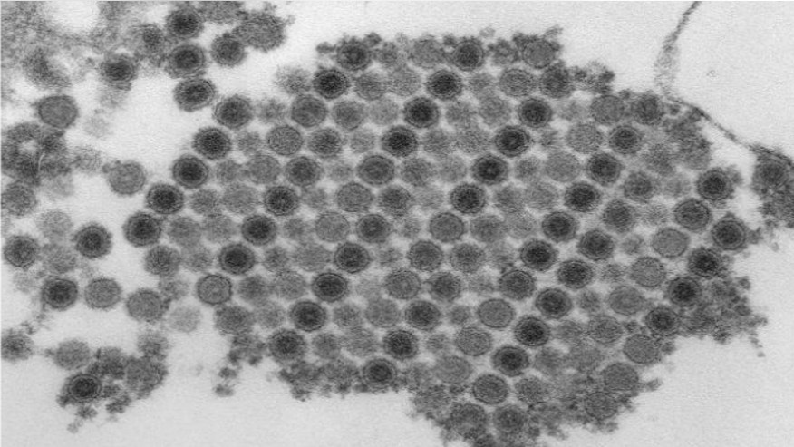 Chikungunya CDC final.jpg