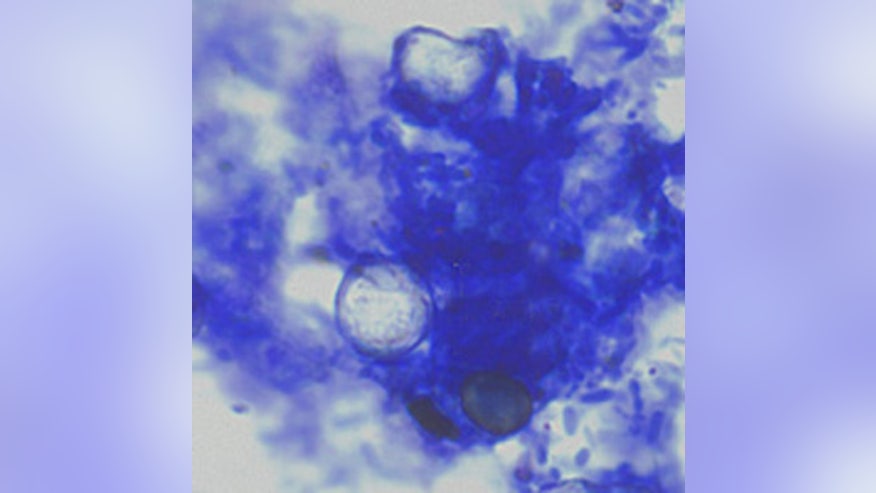 Cyclospora_AF_AZ2.jpg