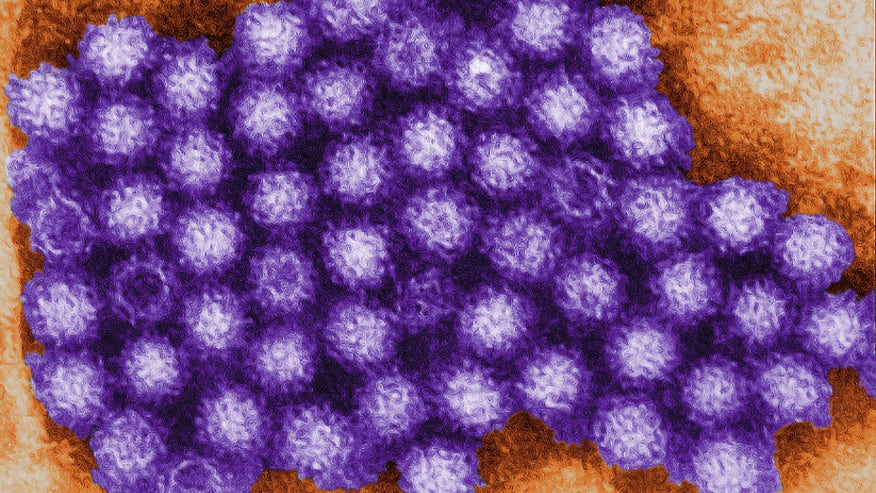 Norovirus1.jpg