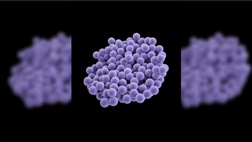 staphylococcus aureus and other infectious bacteria essay Staphylococcus aureus infections are usually treated with antibiotics, but methicillin-resistant staphylococcus aureus, known as mrsa, is a type of staphylococcus aureus that is resistant to the antibiotic methicillin and other drugs in the same class, including penicillin, amoxicillin, and oxacillin. staphylococcus aureus and other infectious bacteria essay Staphylococcus aureus infections are usually treated with antibiotics, but methicillin-resistant staphylococcus aureus, known as mrsa, is a type of staphylococcus aureus that is resistant to the antibiotic methicillin and other drugs in the same class, including penicillin, amoxicillin, and oxacillin.
