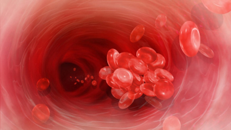 Blood Clot iStock