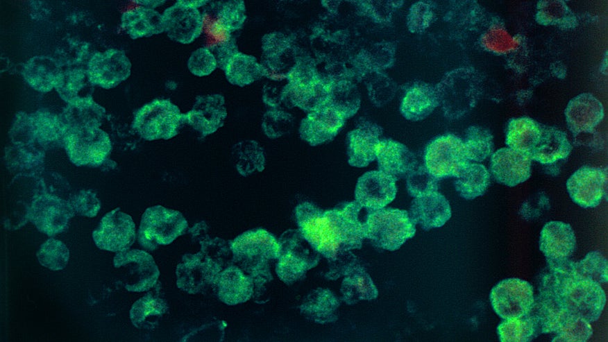 braineatingamoeba.jpg