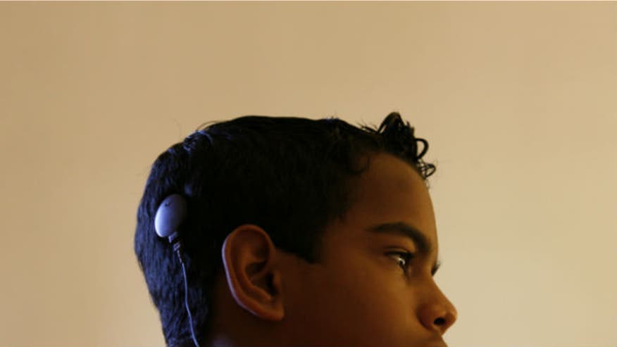 cochlearimplant_reuters.jpg