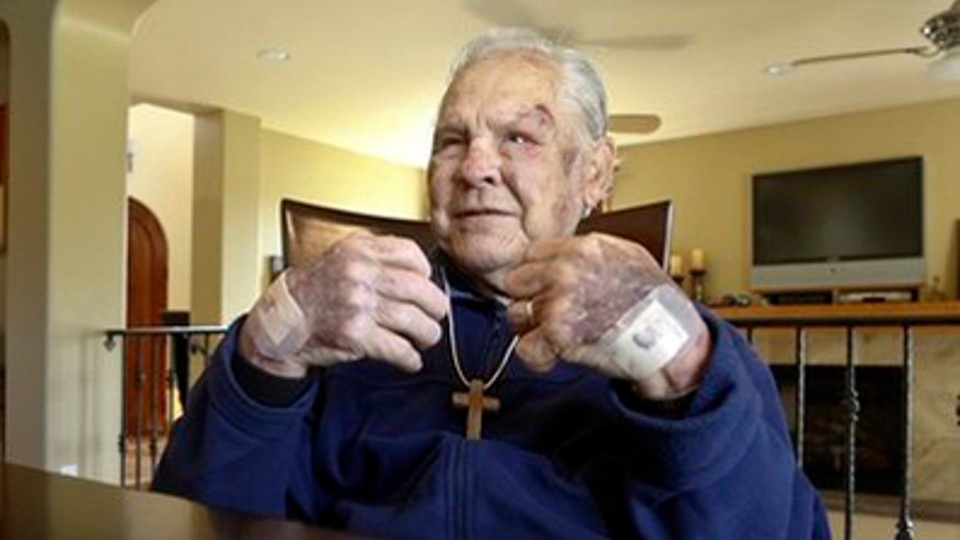 Man Lives With Diabetes for 85 years AP