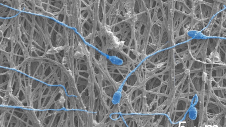 fibers-and-sperm.jpg