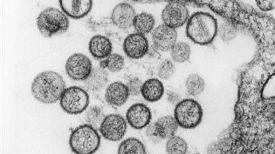 hantavirus