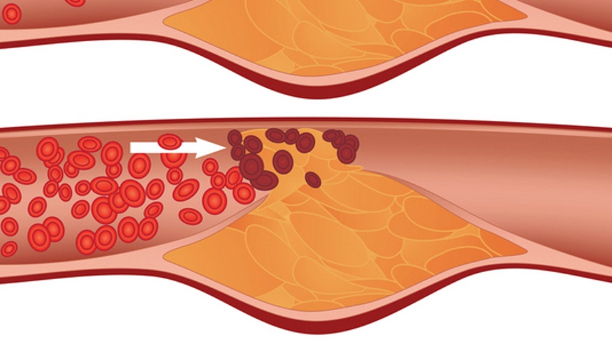 Don’t Take Niacin For Heart Health, Doctors Warn | THE TRUTH SEEKER