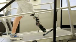 >An innovative neuroprosthetic could eliminate hand controls.