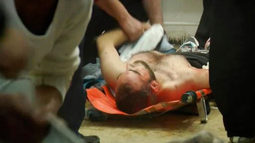 homs_wounded_020712.jpg