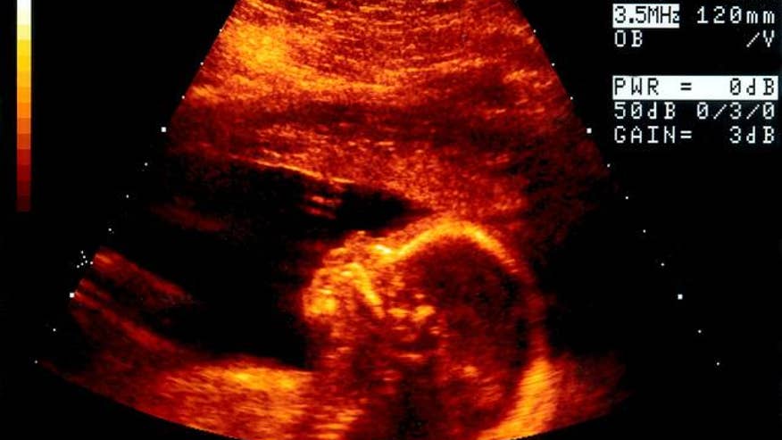 sonogram