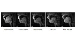 Scientists have used scanners to peer into a beatboxer as he performed his craft to reveal the secrets of this mysterious art.