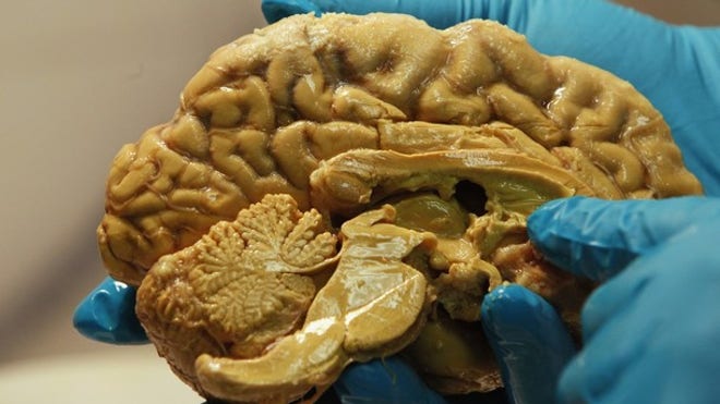 01thebrain.jpg
