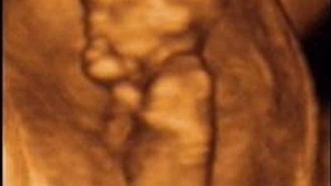 More Detailed Ultrasounds