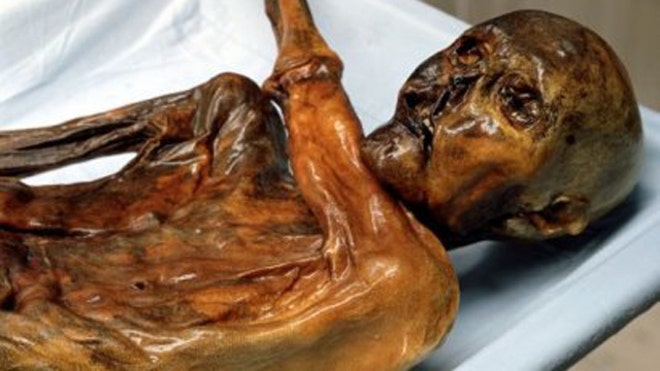 Oetzi, the Iceman