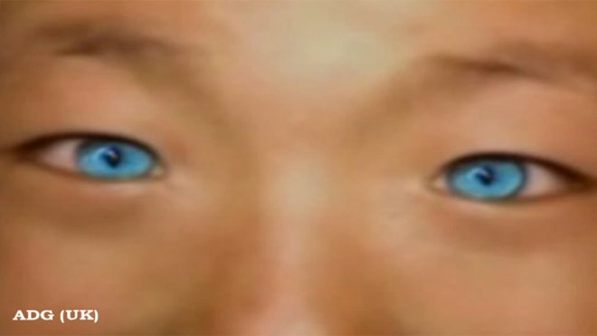 blueeyez - China's Cat-Eyed Boy - Weird and Extreme blueeyez - China's Cat-Eyed Boy - Weird and Extreme