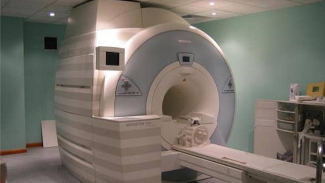 brain scan fmri