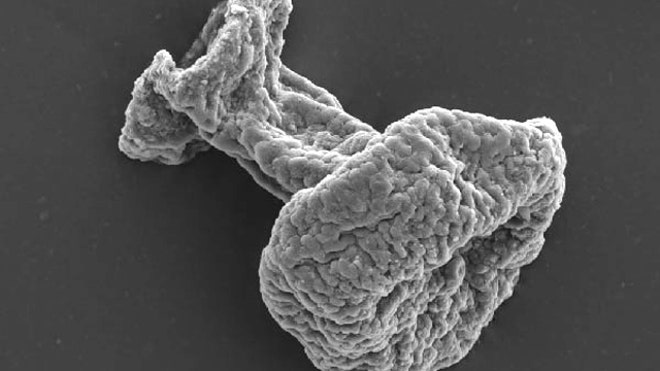 ciliate-fossil-edited.jpg