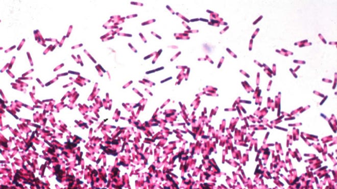clostridium difficile
