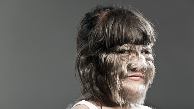 World's Hairiest Girl