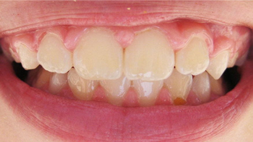 teeth.jpg