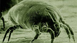 >When viewed up close beneath the unblinking eye of the microscope, the tiniest mites and most harmless of insects become terrifying beasts to haunt your dreams.