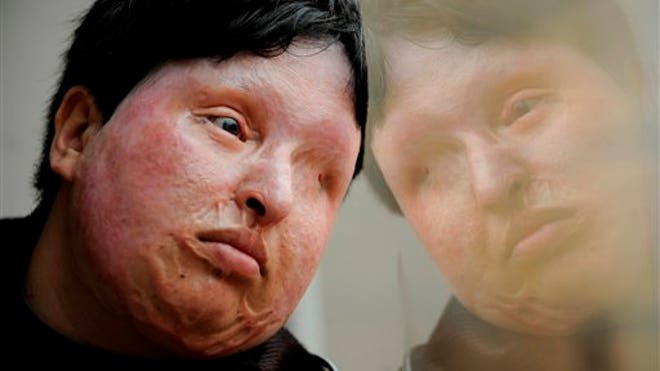 iranian_acid_woman