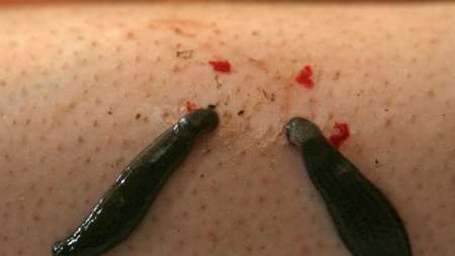 leech