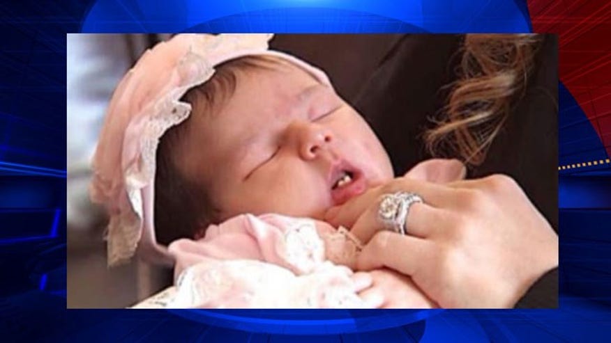 Missouri baby born with two front teeth Babywithteeth551