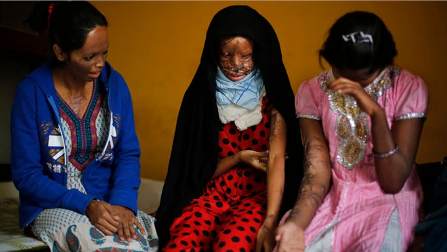 india-acid-attack-victims.jpg