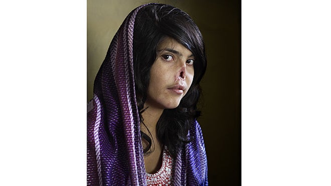 Disfigured Afghan woman world photo winner