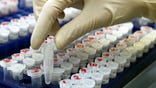 The highest U.S. court ruled Thursday biotech companies can’t patent your genes. But they can stake claim to derivatives made from the building blocks of nearly all living things.