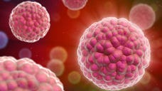 A -year-old girl from the U.K., who was diagnosed with a rare childhood cancer, is now in remission after being treated with a new radioactive antibody