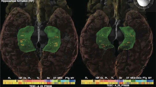 brain-genetics-120415