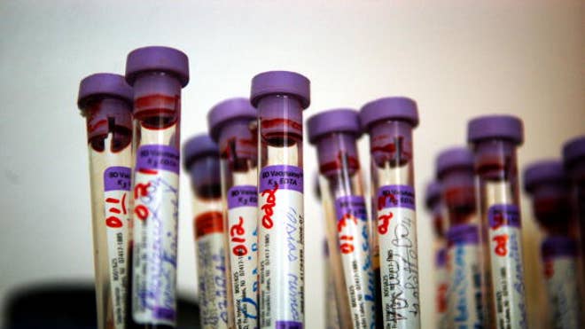 Blood_Tests.jpg
