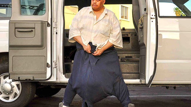 132+Pound+Scrotum ... Documents ‘Man With The 132 Pound Scrotum’ | Fox News Latino