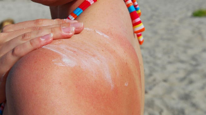 Getting a &lsquo;base tan&rsquo; will protect my skin from sun damage