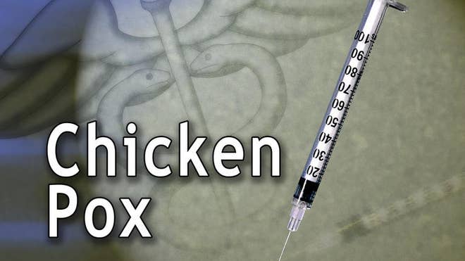 Chickenpox