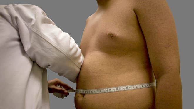 Obesity