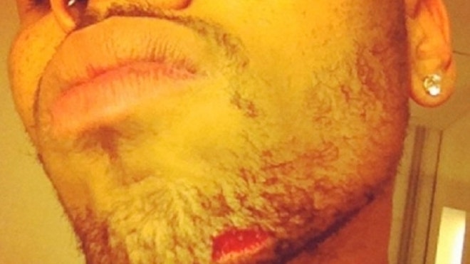 Hotheaded hip-hop stars Drake and Chris Brown turned a SoHo nightclub into a blood-soaked battlefield yesterday as they — and their entourages — fought with fists and bottles over the affections of R