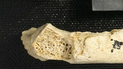 The oldest human tumor ever found by more than , years has been discovered in the rib of a Neanderthal.