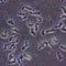 9-year-old Kansas girl dies after contracting brain-eating amoeba