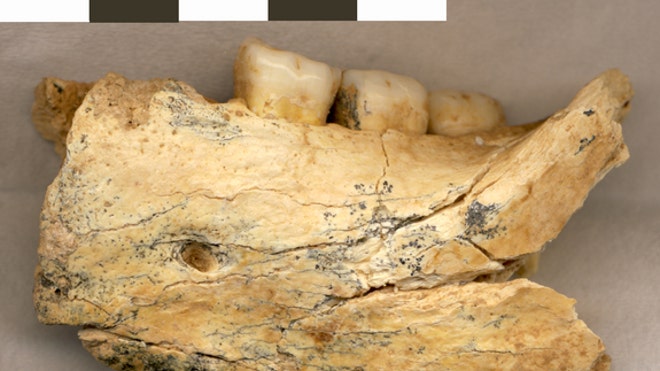 jawbone