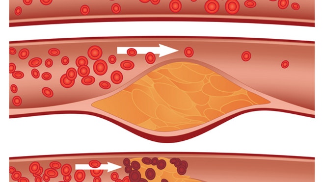 shutterstock_61058215